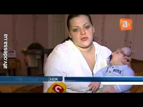 В  Одессе живёт единственный в мире малыш без черепа - Популярные видеоролики!