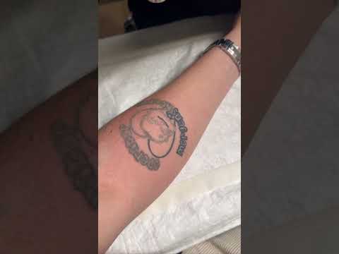 Фраме Тамер удаляет татуировку 'Оператор Моргенштерна' - Популярные видеоролики!