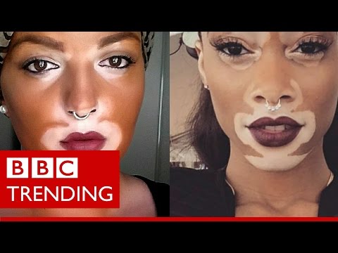 Winnie Harlow - The model who's bringing vitiligo into the open - BBC Trending - Популярные видеоролики!